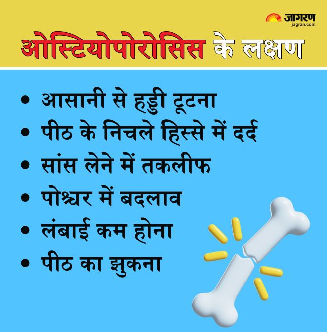 Osteoporosis Prevention